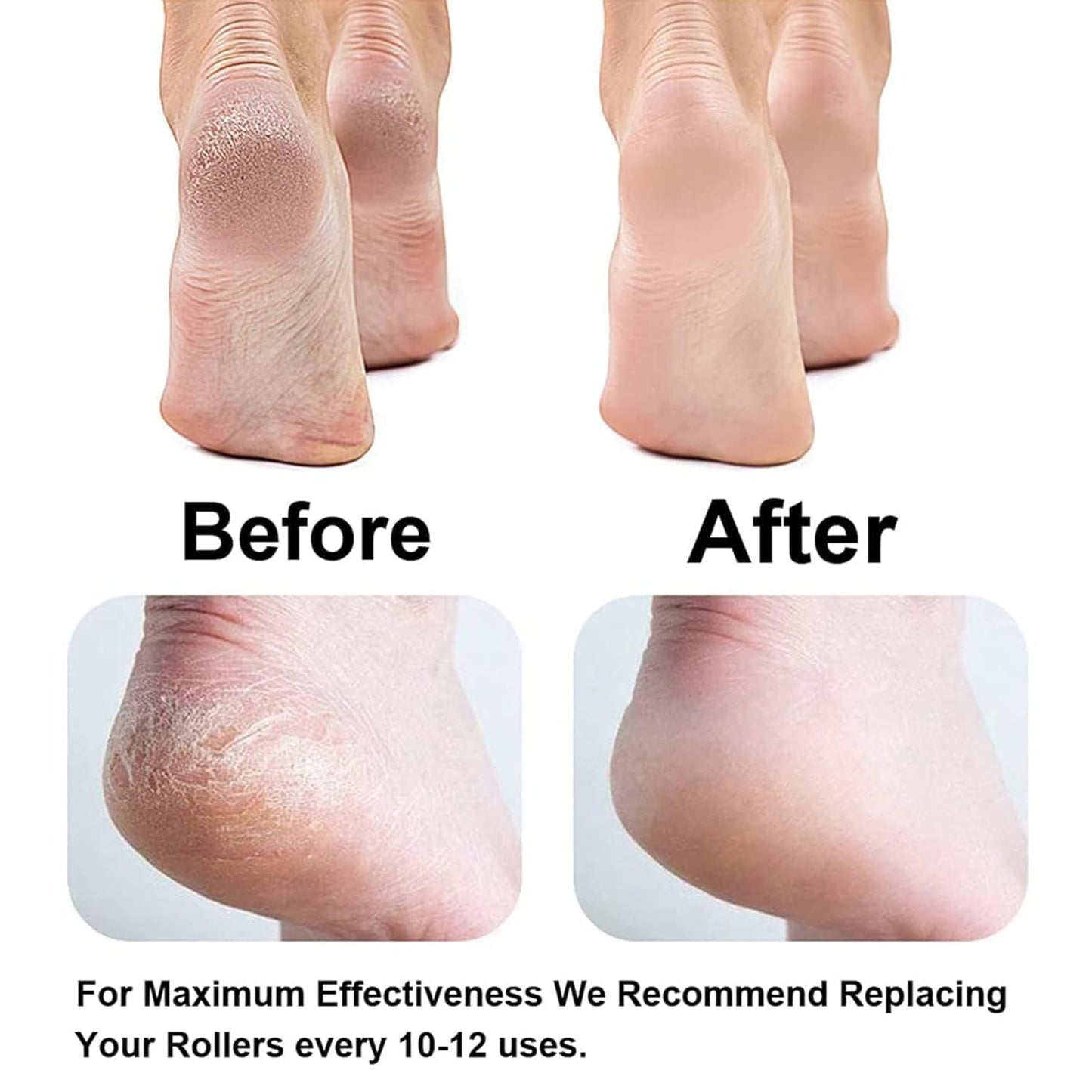 Electric Pedicure Foot File Callus Remov...