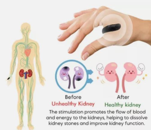 Sugar Control LI4 Acupressure Point Clip (BUY 1 GET 1 Free)